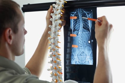 Asociación entre la alineación espinal y la composición bioquímica de la intervertebral lumbar - alineación espinal y la composición bioquímica de la intervertebral lumbar