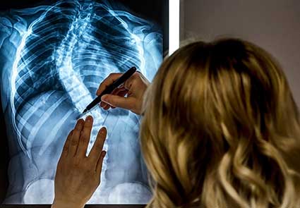 Comprender la escoliosis y los objetivos de la atención - la escoliosis es más que un ángulo de Cobb