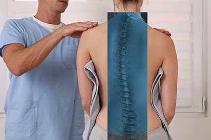 Sunset Chiropractic & Wellness Research Review: Association Between Incorrect Posture and Scoliosis - What should I do if I have abnormal posture or suspect possible scoliosis?