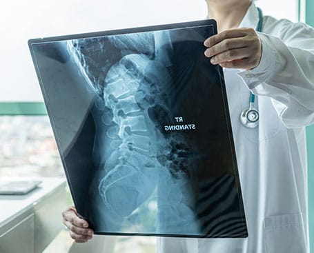 Determining The True Cause of Your Back Pain, Neck Pain, & Headaches. - Digital posture analysis and x-rays