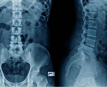 Sunset Chiropractic and Wellness: Holistic approach that heals not only the pain, but the cause - What effect all these changes have on the body, besides pain?