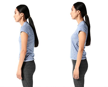 Sunset Chiropractic & Wellness Research Review: Relationships between forward head posture and lumbopelvic sagittal alignment in older adults with chronic low back pain - Abnormal spinopelvic posture