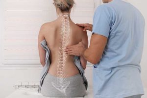 Top Scoliosis Facts 2022 - Scoliosis Facts