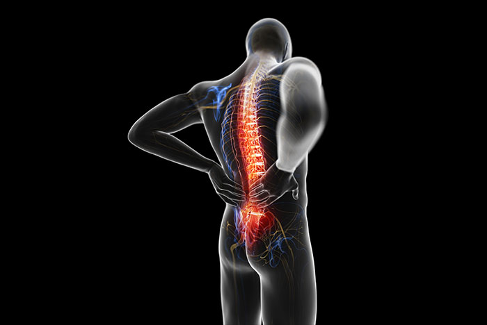 ¿Cuidado quiropráctico de corrección estructural para el dolor de espalda? - Atención quiropráctica para el dolor de espalda