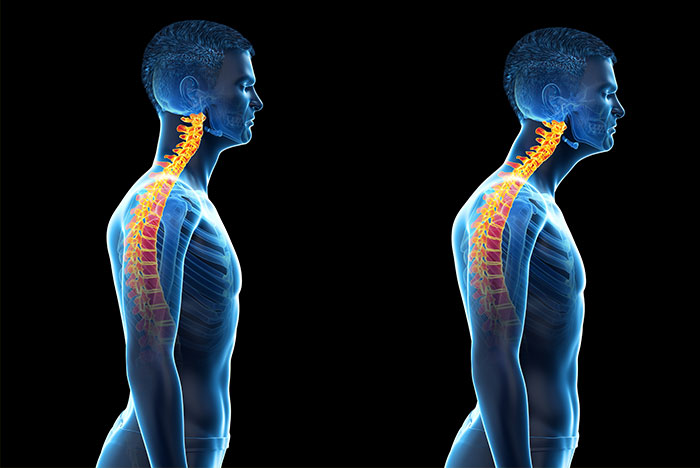 : Sunset Chiropractic & Wellness Research Review: The relationship between forward head posture, postural control and gait: A systematic review.Current evidence supports an association between FHP and a detrimental alteration in limits of stability, performance-based balance, and cervical proprioception.