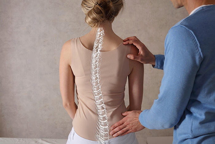 Sunset Chiropractic & Wellness: Scoliosis Diagnosis and Traditional Treatment Model. Once the scoliosis is 25 degrees a rigid brace with the primary goal only to stabilize the progression is prescribed.