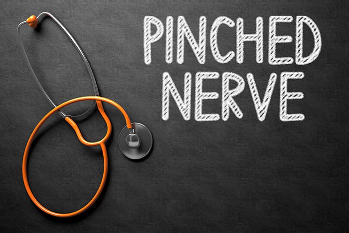 Sunset Chiropractic & Wellness Review: La eficacia de la rehabilitación de la lordosis cervical para la función de la raíz nerviosa y el dolor en la radiculopatía cervical espondilótica: un ensayo aleatorizado con seguimiento de 2 años. La lordosis cervical mejorada en el grupo de estudio se correlacionó con mejoras significativas en la función de la raíz nerviosa y la calificación del dolor en pacientes con radiculopatía espondilótica cervical en el seguimiento a corto y largo plazo.