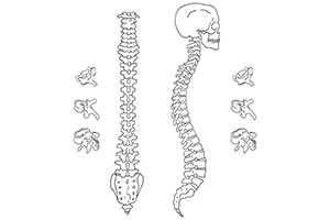 Sunset Chiropractic and Wellness. Loss of Cervical Lordosis Causing Disc Herniation? There are a number of things that can cause loss of cervical lordosis.